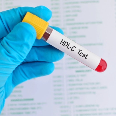 Cholesterol nie-HDL: co to jest, normy, przeliczniki