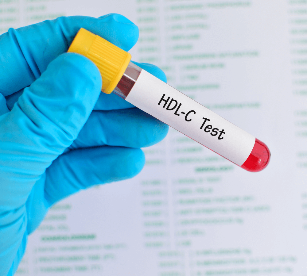 Cholesterol nie-HDL: co to jest, normy, przeliczniki